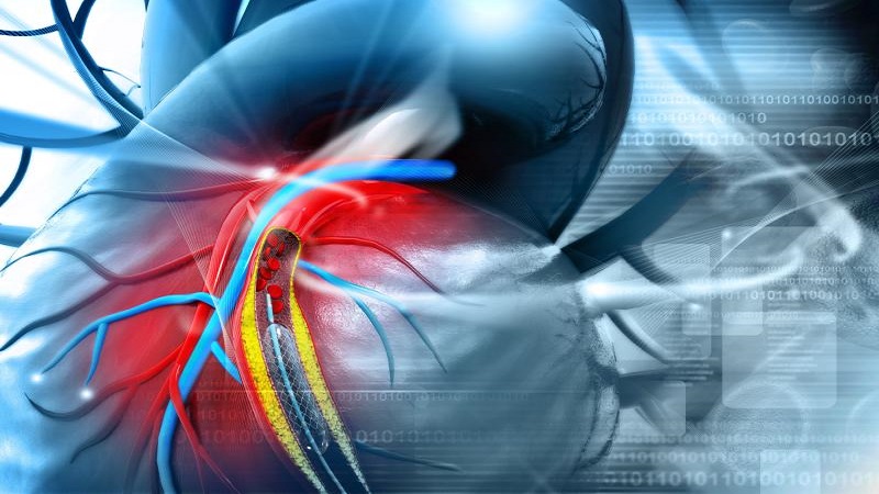 متخصص قلب اصفهان عوارض آنژیوگرافی قلب