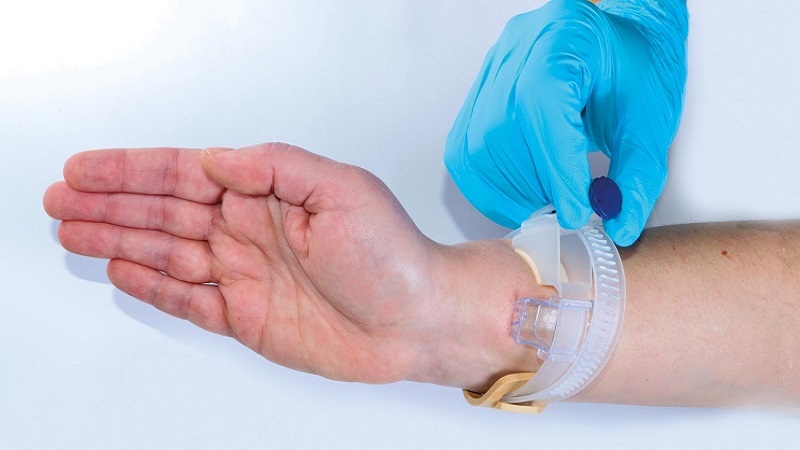 آنژیوگرافی از طریق دست و روش انجام آن | متخصص قلب اصفهان