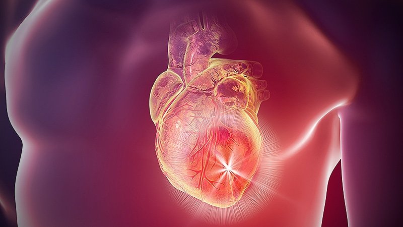 بررسی علل بروز میوکاردیت | متخصص قلب اصفهان