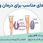 ورزش‌های مناسب برای درمان واریس | متخصص واریس اصفهان - درمان واریس در اصفهان