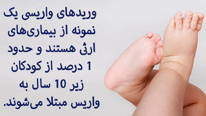 تشخیص واریس در کودکان | دکتر مهرداد طاهریون بهترین متخصص واریس اصفهان