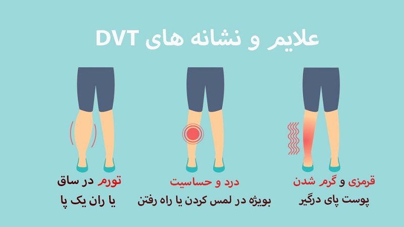 علائم بیماری DVT|دکتر مهرداد طاهریون بهترین متخصص واریس اصفهان