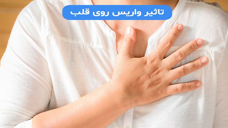 چگونه اثرات واریس بر قلب را کاهش دهیم؟| دکتر مهرداد طاهریون متخصص قلب اصفهان