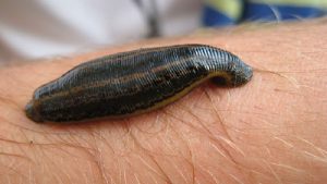 زالو درمانی | بهترین متخصص واریس اصفهان - متخصص قلب اصفهان