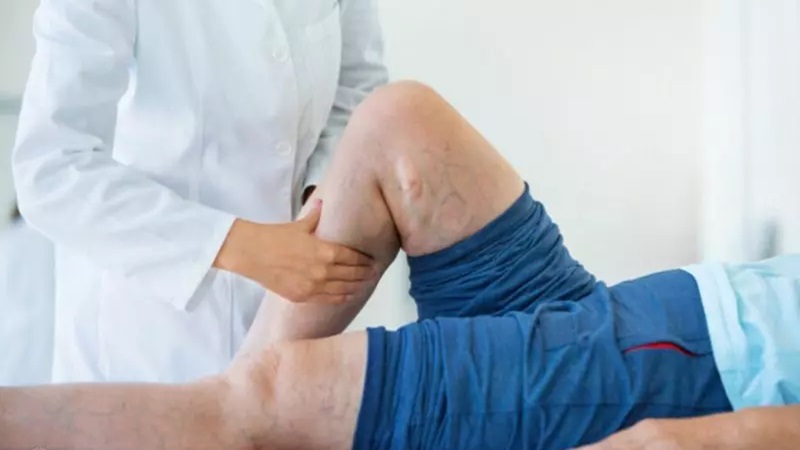 عوامل ژنتیکی و واریس | بهترین متخصص واریس اصفهان - متخصص قلب اصفهان | دکتر مهرداد طاهریون