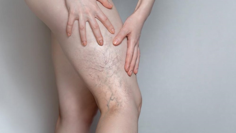دکتر مهرداد طاهریون (بهترین متخصص واریس اصفهان - متخصص قلب اصفهان)