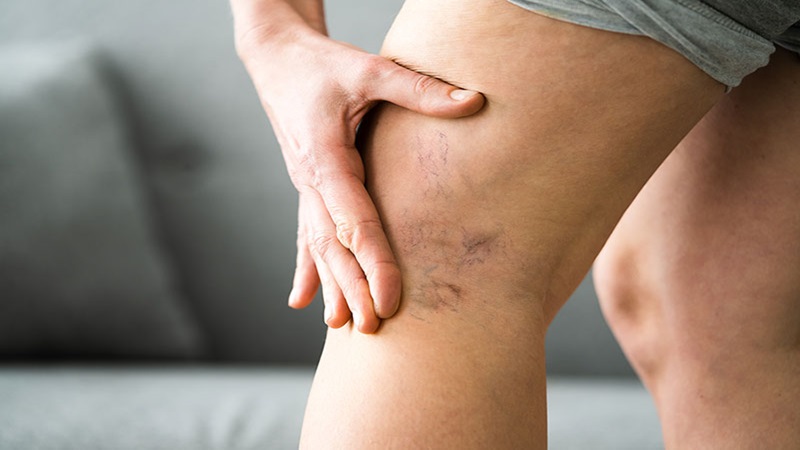 دکتر مهرداد طاهریون (بهترین متخصص واریس اصفهان - متخصص قلب اصفهان)