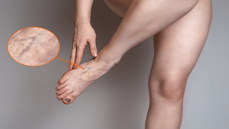 دکتر مهرداد طاهریون (بهترین متخصص واریس اصفهان - متخصص قلب اصفهان)