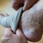 تأثیر هورمون‌ها بر سلامت قلب و واریس | دکتر مهرداد طاهریون (بهترین متخصص واریس اصفهان - متخصص قلب اصفهان)