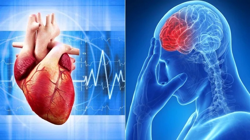 مشکلات قلبی و ریسک سکته مغزی | دکتر مهرداد طاهریون (بهترین متخصص واریس اصفهان - متخصص قلب اصفهان)