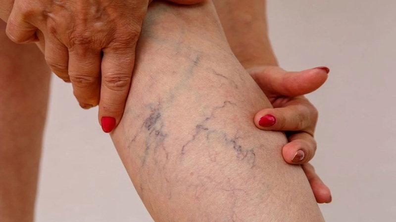 مشاغل پرخطر برای ایجاد واریس | دکتر مهرداد طاهریون (بهترین متخصص واریس اصفهان - متخصص قلب اصفهان)