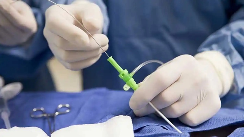 فرآیند و تکنیکهای آنژیوپلاستی | بهترین متخصص واریس اصفهان - متخصص قلب اصفهان | دکتر مهرداد طاهریون