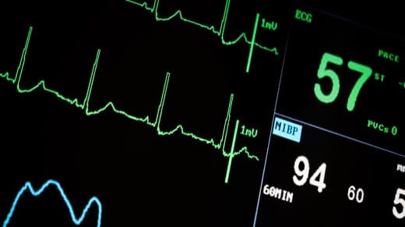 تحلیل نوار قلب و تشخیص زودهنگام آریتمیها | بهترین متخصص واریس اصفهان - متخصص قلب اصفهان | دکتر مهرداد طاهریون